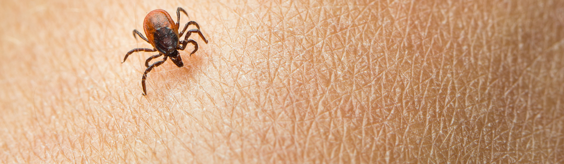 La picadura de garrapata puede acarrearte serios problemas de salud (iStock).